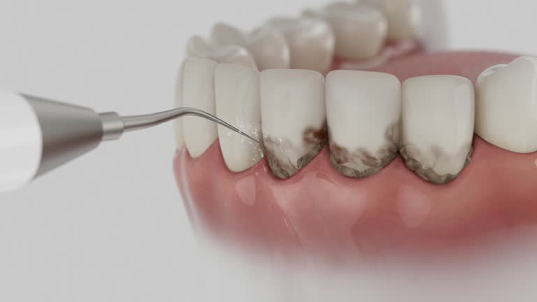 Reliable Invisalign Clear Aligners contractor in Ball, LA by Smile Center Dentistry